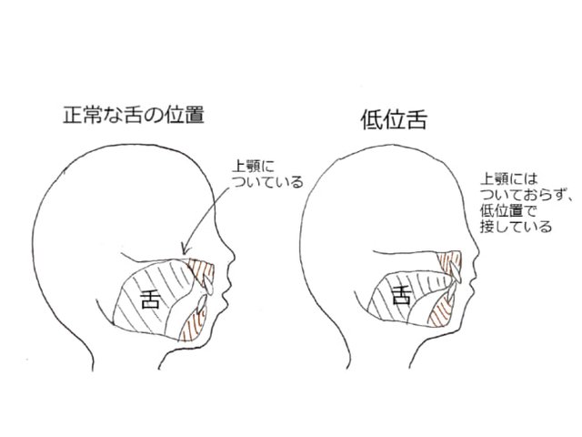 低位舌 Japaneseclass Jp