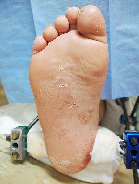 Dr Hisamichiのkeep On Walkin Vol 2あなたは夏の 虫 を大切に育てている Aging Gracefully わたしらしく輝く