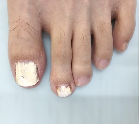 Dr Hisamichiのkeep On Walkin Vol 2あなたは夏の 虫 を大切に育てている Aging Gracefully わたしらしく輝く